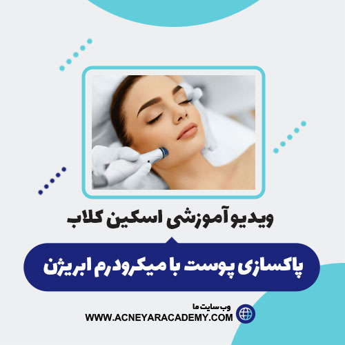 پاکسازی-پوست-با-میکرودرم-ابریژن